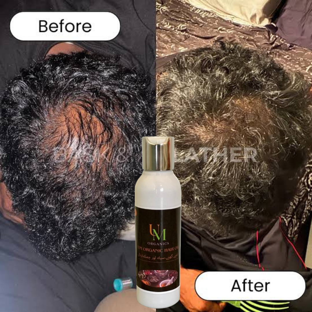 UM Organics hair oil |The hair doctor | 150ML
