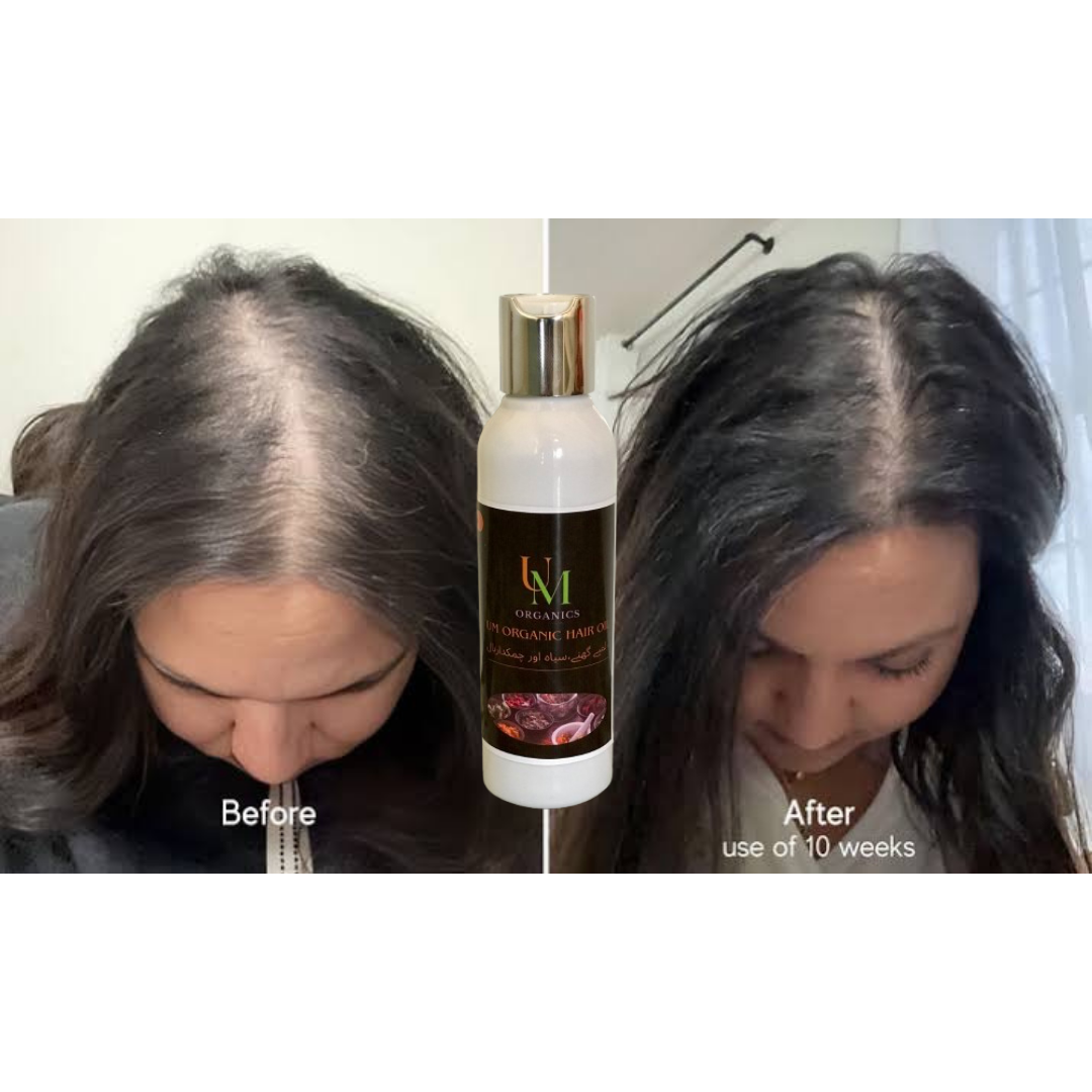 UM Organics hair oil |The hair doctor | 150ML